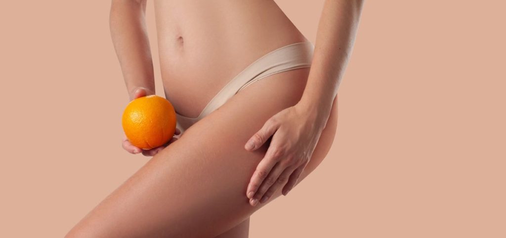 La celulitis o piel de naranja es un problema de salud, además de estético que afecta a las mujeres